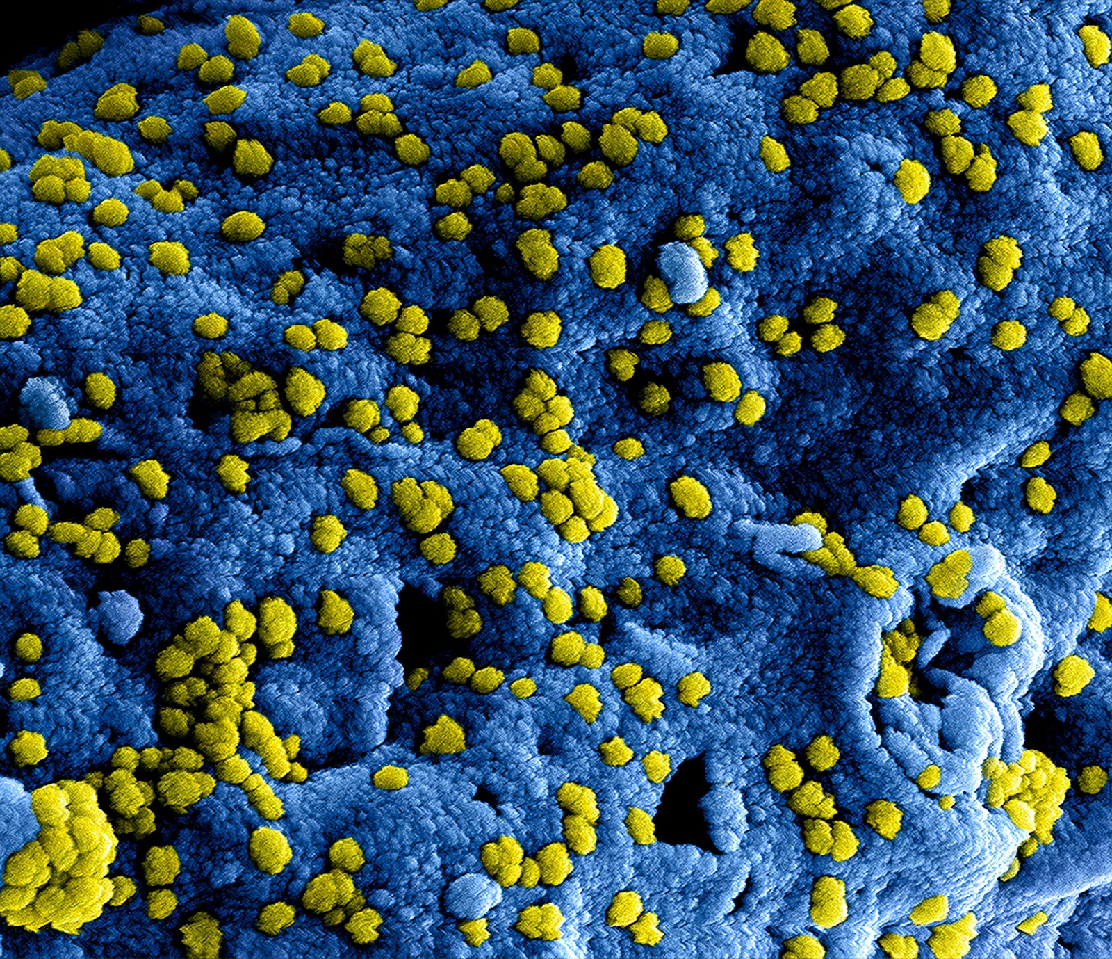 The Fever Line Moves North: How Climate Change is Redrawing the Map of Infectious Disease